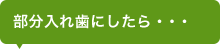 部分入れ歯にしたら・・・