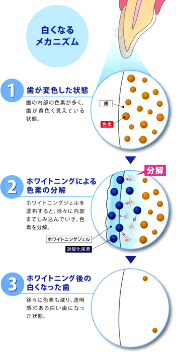 歯が白くなるメカニズム